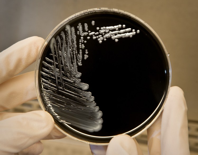 Legionella pneumophila, a bacterium that can cause Legionnaires’ disease, is shown growing on specialized microbiological media in an image provided by the Centers for Disease Control and Prevention.