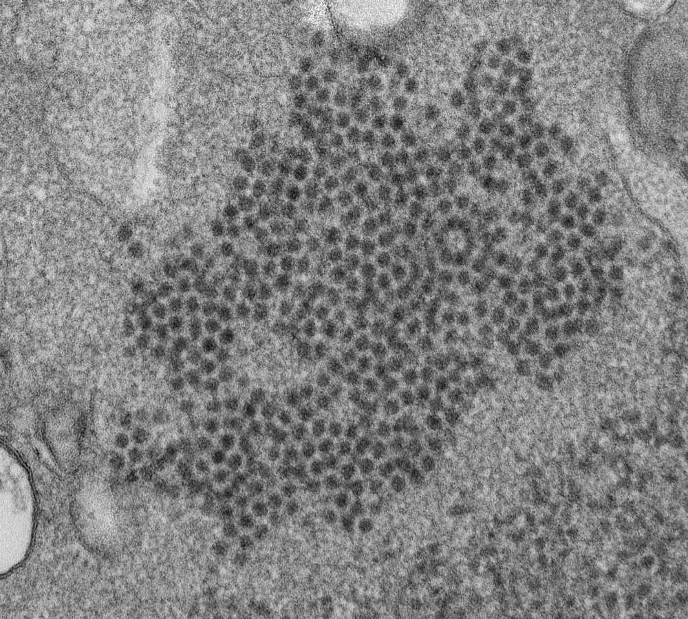 Paralyzing_Illness_72969