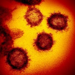 Virus_Outbreak_Home_Test_75196