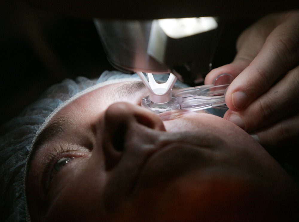 PARKER KRAFF LASIK
