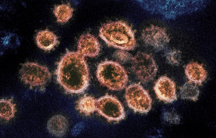 This 2020 electron microscope image provided by the National Institute of Allergy and Infectious Diseases – Rocky Mountain Laboratories shows SARS-CoV-2 virus particles which cause COVID-19, isolated from a patient in the U.S., emerging from the surface of cells cultured in a lab. According to two new studies released on Tuesday, people who have antibodies from infection with the coronavirus seem less likely to get a second infection for several months and maybe longer. 