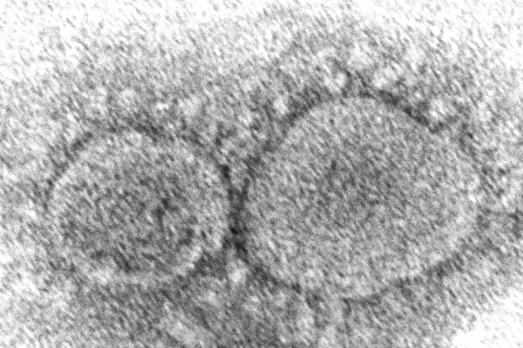 This 2020 electron microscope image  shows SARS-CoV-2 virus particles which cause COVID-19. According to research released in 2021, evidence is mounting that having COVID-19 may not protect against getting infected again with some of the new variants. People also can get second infections with earlier versions of the coronavirus if they mounted a weak defense the first time. 