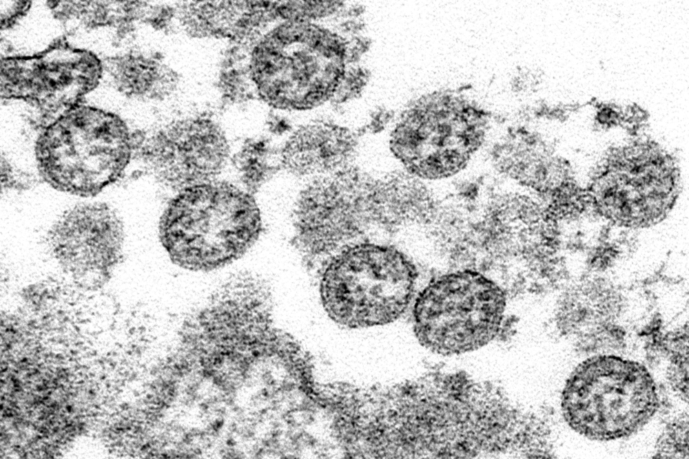 Virus_Outbreak_First_US_Infections_64684