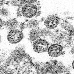 Virus_Outbreak_First_US_Infections_64684