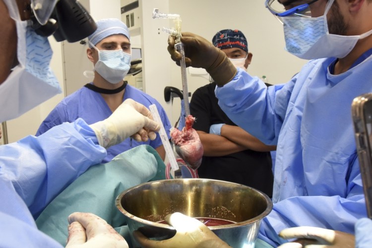 CORRECTION Pig Heart Transplant