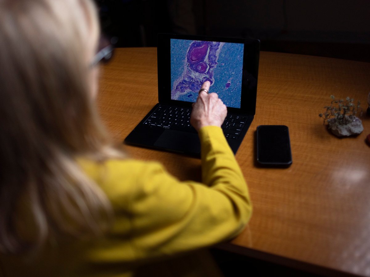 What the Lewiston shooter’s brain injury can tell us about blast exposure in the military